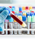 hand of a lab technician holding blood tube test and background a rack of color tubes with blood samples other patients / laboratory technician holding a blood tube test