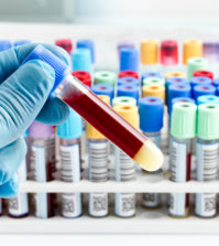 hand of a lab technician holding blood tube test and background a rack of color tubes with blood samples other patients / laboratory technician holding a blood tube test